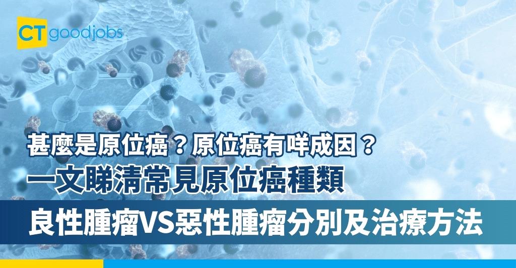 【甚麼是原位癌？】原位癌成因是甚麼？一文睇清常見原位癌種類、良性腫瘤VS惡性腫瘤分別及治療方法
