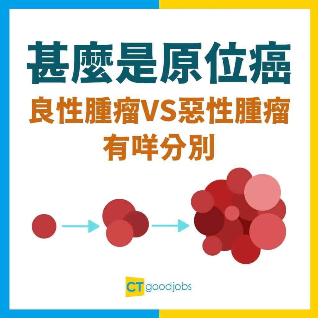 【甚麼是原位癌？】原位癌成因是甚麼？一文睇清常見原位癌種類、良性腫瘤VS惡性腫瘤分別及治療方法